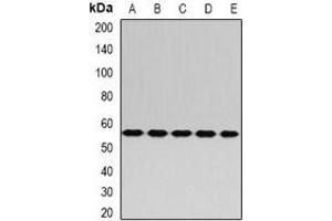 Western blot analysis of RABIN3 expression in Hela (A), A549 (B), mouse kidney (C), mouse liver (D), rat brain (E) whole cell lysates. (RAB3IP anticorps)