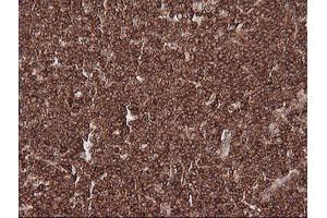 Image no. 4 for anti-Melanoma Antigen Family A, 4 (MAGEA4) antibody (ABIN1499260)