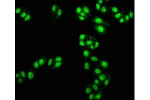Immunofluorescence staining of HepG2 cells with ABIN7171330 at 1:100, counter-stained with DAPI. (TAL1 anticorps  (AA 1-114))