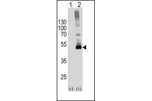 Western blot analysis of SPHK1-M1 Antibody (arrow) using rabbit polyclonal SPHK1-M1 Antibody (ABIN391345 and ABIN2841366). (SPHK1 anticorps  (N-Term))