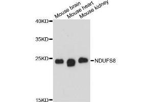 Western blot analysis of extracts of various cell lines, using NDUFS8 antibody. (NDUFS8 anticorps  (AA 35-210))
