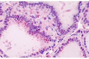 Human Thyroid: Formalin-Fixed, Paraffin-Embedded (FFPE) (UBE2N anticorps  (AA 40-51))