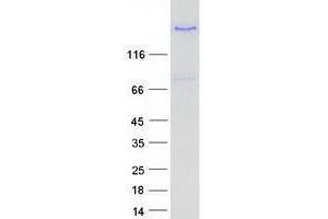 Validation with Western Blot