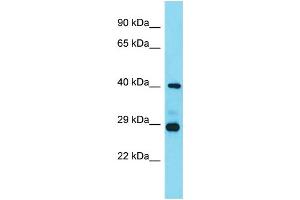Host: Rabbit  Target Name: Lhfpl3  Sample Tissue: Mouse Heart lysates  Antibody Dilution: 1. (LHFPL3 anticorps  (C-Term))