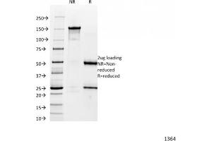 SDS-PAGE Analysis Purified Catenin, alpha-1 Mouse Monoclonal Antibody (1G5).