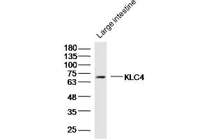 Mouse large intestine lysates probed with KLC4 Polyclonal Antibody, Unconjugated  at 1:300 dilution and 4˚C overnight incubation. (KLC4 anticorps  (AA 51-150))