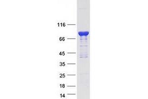 Validation with Western Blot