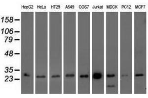 Image no. 3 for anti-OTU Domain, Ubiquitin Aldehyde Binding 2 (OTUB2) antibody (ABIN1499938) (OTUB2 anticorps)