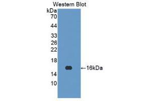 Western blot analysis of the recombinant protein. (Interferon gamma anticorps  (AA 24-166))