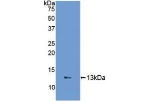 Detection of Recombinant FABP1, Human using Polyclonal Antibody to Fatty Acid Binding Protein 1 (FABP1) (FABP1 anticorps  (AA 2-127))