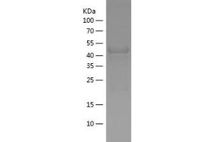 Western Blotting (WB) image for Protein Inhibitor of Activated STAT, 4 (PIAS4) (AA 334-510) protein (His-IF2DI Tag) (ABIN7124650)
