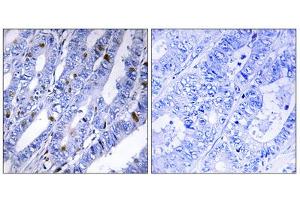 Immunohistochemistry (IHC) image for anti-Protein Kinase, CAMP-Dependent, Regulatory, Type II, beta (PRKAR2B) (Ser113) antibody (ABIN1848032)