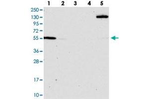 Western blot analysis of Lane 1: RT-4, Lane 2: U-251 MG, Lane 3: Human Plasma, Lane 4: Liver, Lane 5: Tonsil with OSBPL2 polyclonal antibody  at 1:100-1:250 dilution. (OSBPL2 anticorps)