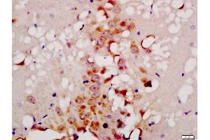 Formalin-fixed and paraffin embedded rat brain labeled with Anti-TG9B Polyclonal Antibody, Unconjugated  at 1:200 followed by conjugation to the secondary antibody and DAB staining (ATG9B anticorps  (AA 351-450))