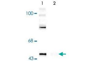 Western blot of rat cortex lysate showing specific immunolabeling of the ~50k Gap43 protein phosphorylated at Ser41 (Control). (GAP43 anticorps  (pSer41))