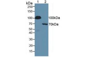 Figure. (SERPING1 anticorps  (AA 399-500))