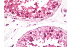 anti-THO Complex 1 (THOC1) (AA 1-404) antibody