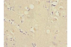 Immunohistochemistry of paraffin-embedded human brain tissue using ABIN7167403 at dilution of 1:100