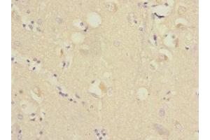 Immunohistochemistry of paraffin-embedded human brain tissue using ABIN7167403 at dilution of 1:100 (RAP2B anticorps  (AA 1-183))