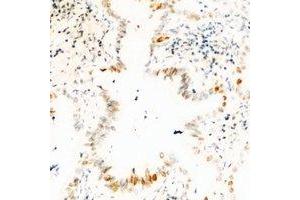 Immunohistochemical analysis of USP36 staining in human kidney formalin fixed paraffin embedded tissue section. (USP36 anticorps)