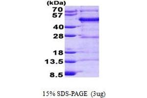 SDS-PAGE (SDS) image for Filamin Binding LIM Protein 1 (FBLIM1) (AA 1-373) protein (His tag) (ABIN6387197)
