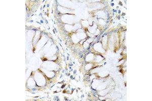 Immunohistochemistry of paraffin-embedded human colon using PI3 antibody at dilution of 1:100 (40x lens). (PI3 anticorps)