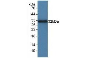 Detection of Recombinant ITGaD, Rat using Polyclonal Antibody to Integrin Alpha D (ITGaD) (ITGAD anticorps  (AA 879-1099))