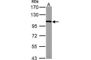 WB Image alpha Actinin 4 antibody [C2C3], C-term detects ACTN4 protein by Western blot analysis.