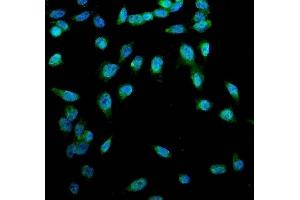 IF analysis of ACSL1 using anti-ACSL1antibody (ABIN4886418).