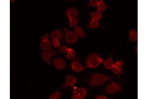 ABIN6268912 staining HepG2 by IF/ICC.