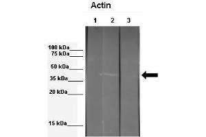 WB Suggested Anti-ACTB Antibody  Positive Control: Lane 1: 341 µg mouse 3T3 ECM extract + blocking peptide, Lane 2: 041 µg mouse 3T3 ECM extract, Lane 3: 041 µg Echinococcus granulosus extract Primary Antibody Dilution: 1:000Secondary Antibody: Anti-rabbit-HRP Secondry  Antibody Dilution: 1:00,000Submitted by: Anonymous (beta Actin anticorps  (Middle Region))