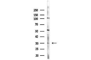 Western blot analysis of lysates from HepG2 cells(LPS,4h treatment), using DHRS9 Antibody at 1/1000 dilution.