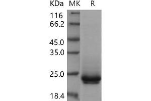 Western Blotting (WB) image for Frizzled Family Receptor 10 (FZD10) protein (His tag) (ABIN7320231)