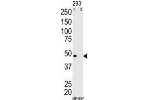 Western Blotting (WB) image for anti-Melanoma Antigen Family A, 11 (MAGEA11) antibody (ABIN3002529)