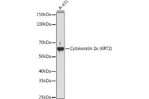 Western blot analysis of extracts of A-431 cells, using Cytokeratin 2e (KRT2) antibody (ABIN1680763, ABIN3016322, ABIN3016323 and ABIN7101480) at 1:1000 dilution.