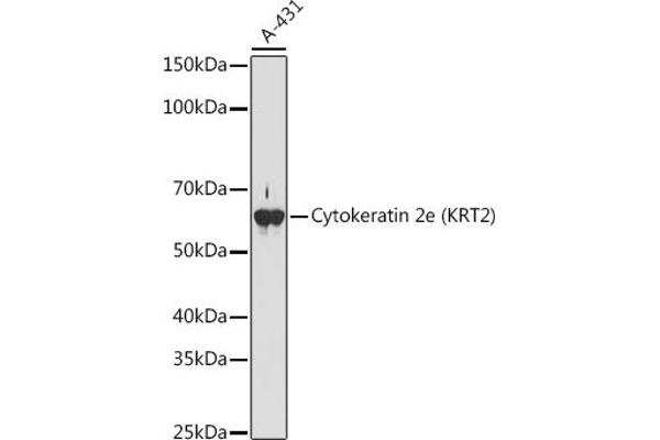 Keratin 2 anticorps