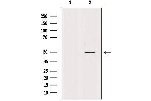 Retinoid X Receptor gamma antibody  (Internal Region)