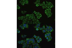 Immunofluorescence analysis of HeLa cells using ECHS1 antibody. (ECHS1 anticorps  (AA 28-290))