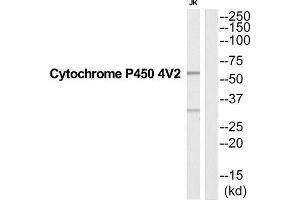 Western Blotting (WB) image for anti-Cytochrome P450, Family 4, Subfamily V, Polypeptide 2 (CYP4V2) (Internal Region) antibody (ABIN1852634) (CYP4V2 anticorps  (Internal Region))