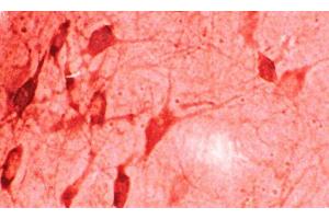 Immunohistochemistry analysis using Rabbit Anti-HO-1 Polyclonal Antibody .