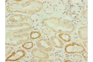 Immunohistochemistry of paraffin-embedded human kidney tissue using ABIN7173949 at dilution of 1:100 (TWIST2 anticorps  (AA 1-70))