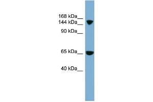 WB Suggested Anti-SLC4A5 Antibody Titration:  0. (NBC4 anticorps  (Middle Region))