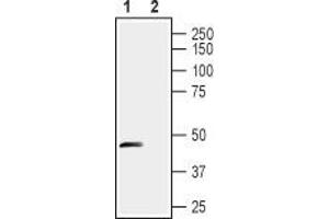 Western blot analysis of rat dorsal root ganglia lysates: - 1. (STOML1 anticorps  (Extracellular, N-Term))