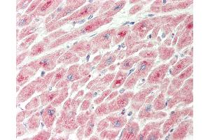 Human Heart: Formalin-Fixed, Paraffin-Embedded (FFPE).