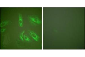 Immunofluorescence analysis of HeLa cells, using Gastrin antibody (ABIN5976408). (Gastrin anticorps  (Internal Region))