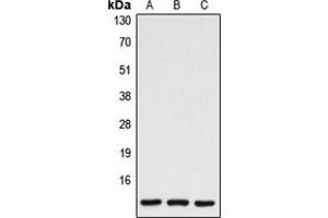Western blot analysis of Caspase 7 p11 expression in HEK293T (A), mouse spleen (B), rat spleen (C) whole cell lysates. (Caspase 7 p11 (Center) anticorps)