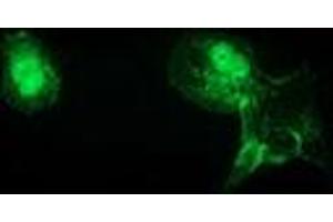 Immunofluorescence (IF) image for anti-Catenin (Cadherin-Associated Protein), beta 1, 88kDa (CTNNB1) antibody (ABIN1496888)