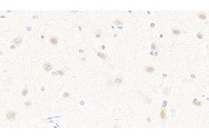 Detection of MAP2K4 in Human Cerebrum Tissue using Polyclonal Antibody to Mitogen Activated Protein Kinase Kinase 4 (MAP2K4)