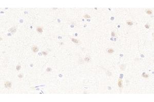 Detection of MAP2K4 in Human Cerebrum Tissue using Polyclonal Antibody to Mitogen Activated Protein Kinase Kinase 4 (MAP2K4) (MAP2K4 anticorps  (AA 137-394))