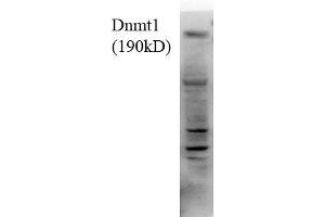 Dnmt1, 18ug H1299 lysate 1 in1000 Western Blotting.